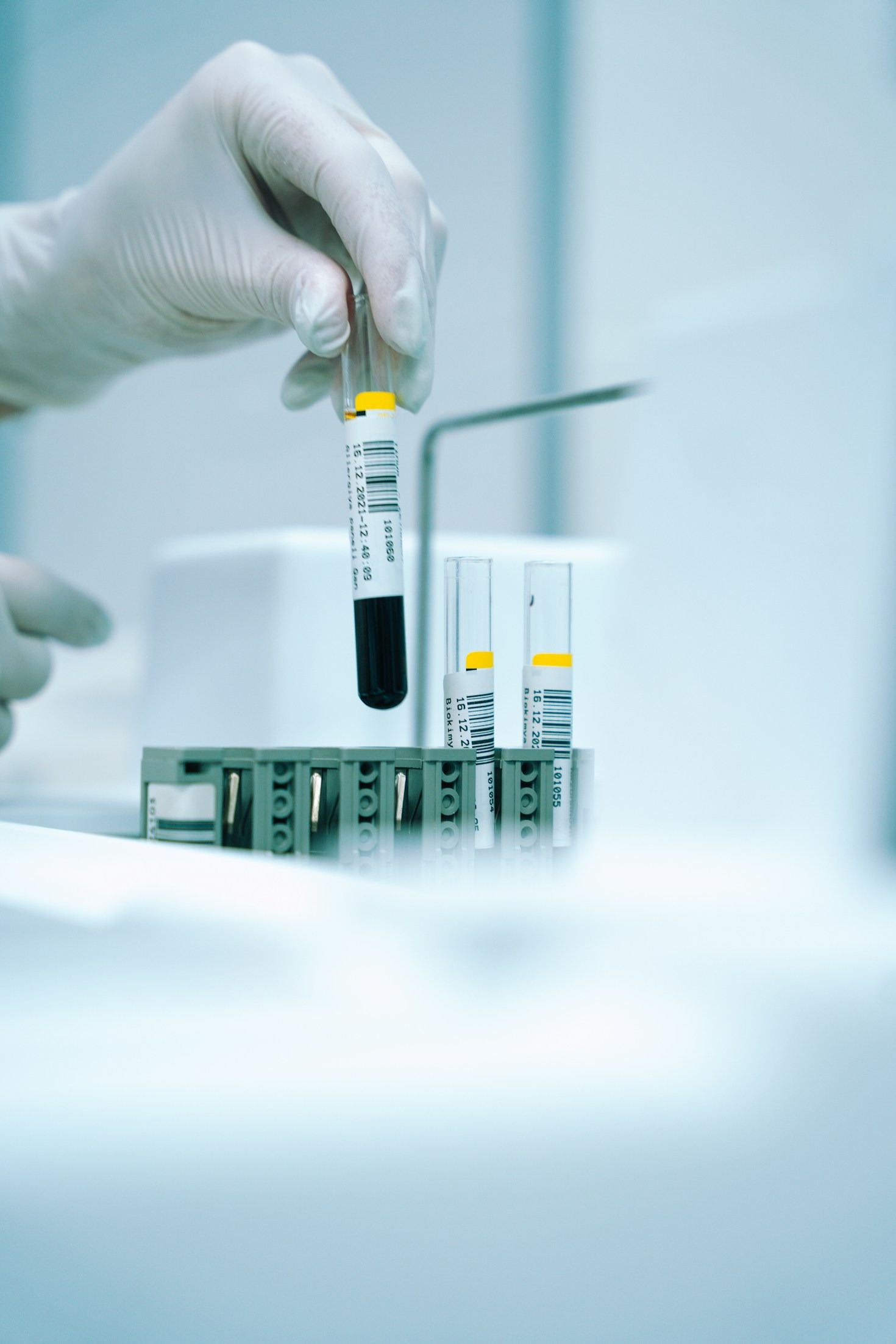 Understanding Purity Standards in Peptide Synthesis